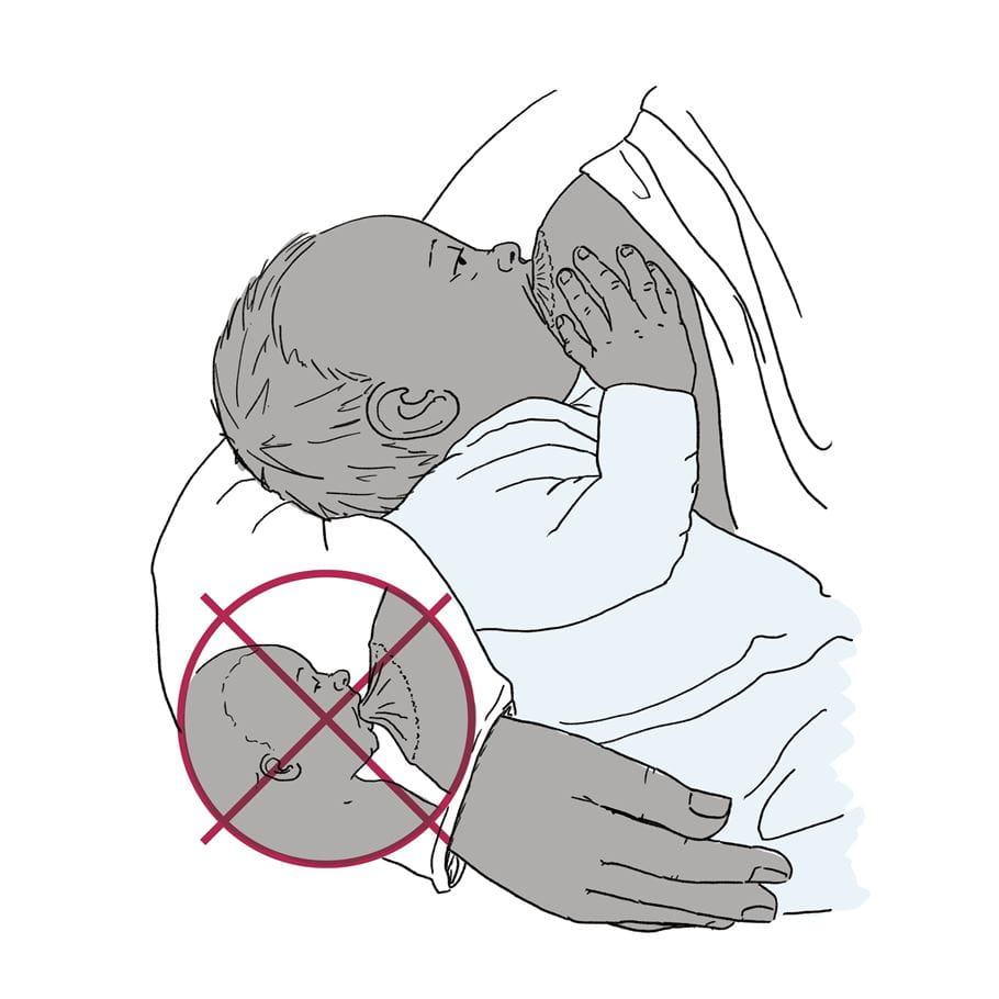 Diagrama mostrando um bebê pegando bem o seio da mãe, com uma ilustração inserida mostrando uma pega inadequada