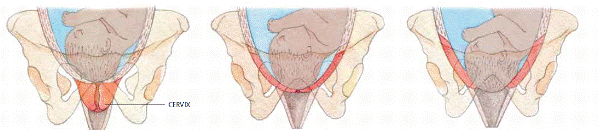 The cervix opens. Illustration by Annabel Milne © Dorling Kindersley