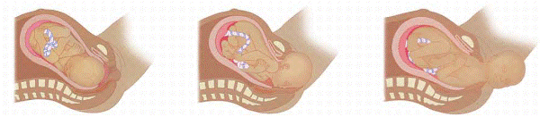 Empurrar o bebê para fora. Ilustrações © Dorling Kindersley